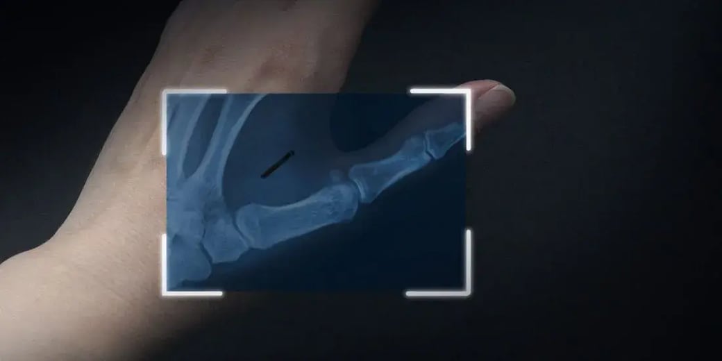 Biohacking Security Concerns